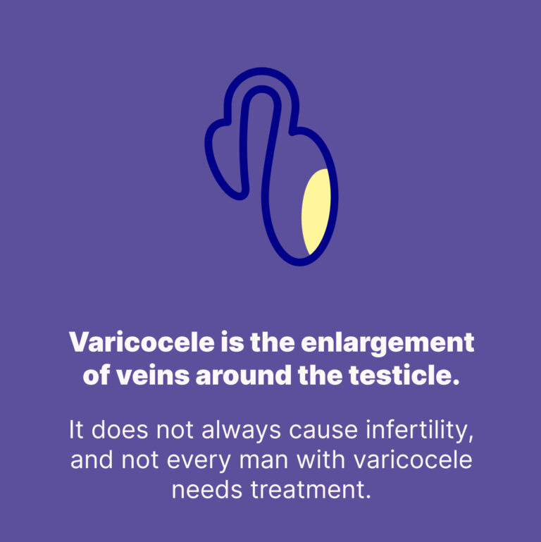 Normal Sperm Analysis but No Pregnancy? The Role of Varicocele in Male Infertility
