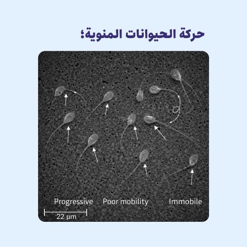 حركة الحيوانات المنوية | ما هي ولماذا تلعب دورًا حيويًا في خصوبة الرجال