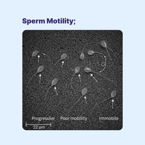 Sperm Motility | What It Is and Why It Plays a Vital Role in Male Fertility