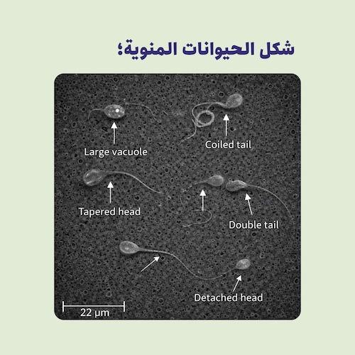 شكل الحيوانات المنوية